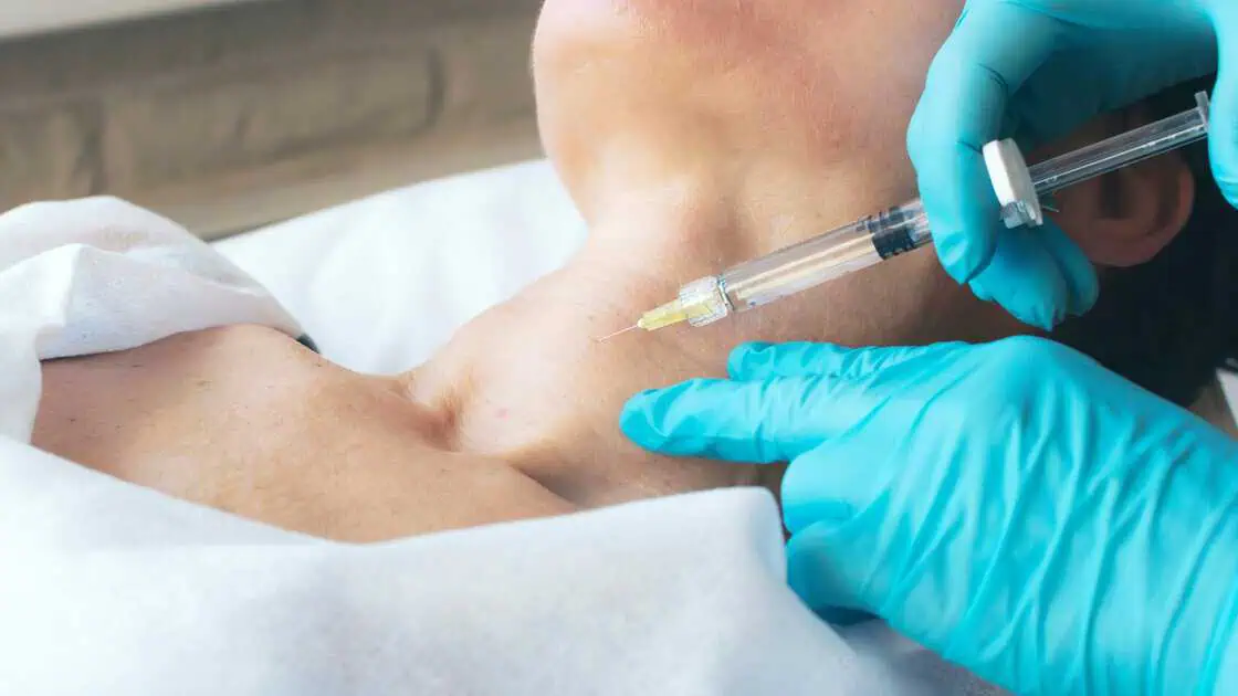 Neurotoxin Injections in Sugar Land, TX by Allure Aesthetics